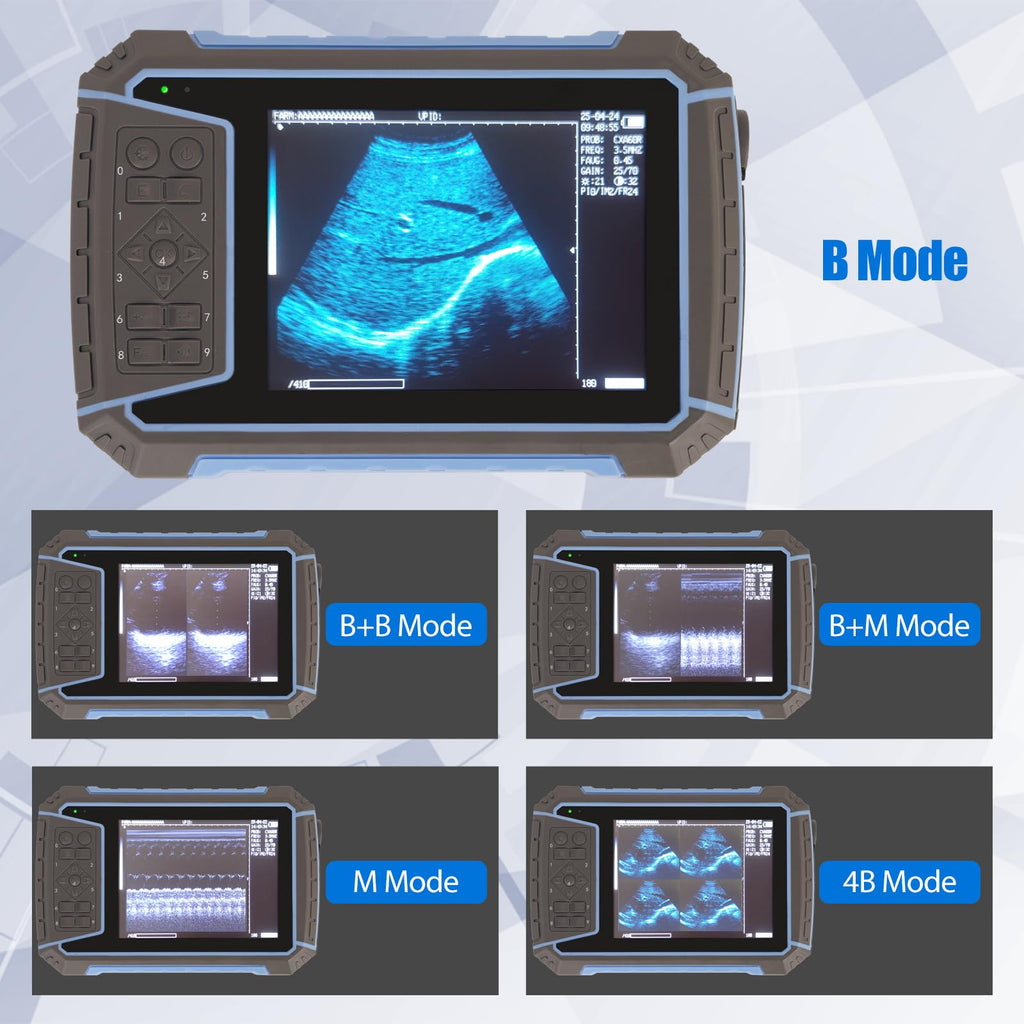 2026 Veterinary Ultrasound Machine for Pregnancy 5.7” HD Display Beginner Vet Handheld Scanner for Cattle, Horse, Pigs, Sheep, Cats, Dogs, Rabbit, Fish